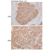 Solarbio K111482P Anti-SLC6A4 Polyclonal Antibody
