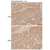 Solarbio K111290P Anti-KANK2 Polyclonal Antibody