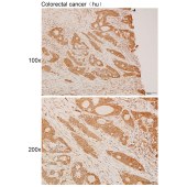 Solarbio K111932P Anti-TFRC Polyclonal Antibody