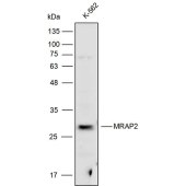 Solarbio K111711P Anti-MRAP2 Polyclonal Antibody