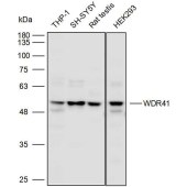 Solarbio K110527P Anti-WDR41 Polyclonal Antibody