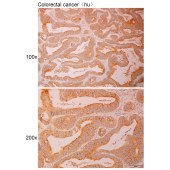 Solarbio K110989P Anti-FKBP3 Polyclonal Antibody