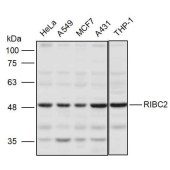 Solarbio K111251P Anti-RIBC2 Polyclonal Antibody