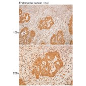 Solarbio K111305P Anti-FASTKD1 Polyclonal Antibody