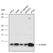 Solarbio K110615P Anti-S100A6 Polyclonal Antibody