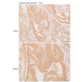 Solarbio K110719P Anti-IARS2 Polyclonal Antibody