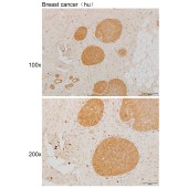 Solarbio K111922P Anti-BRCA1 Polyclonal Antibody