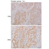 Solarbio K111266P Anti-PPM1L Polyclonal Antibody