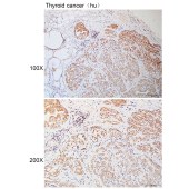 Solarbio K110908P Anti-ALKBH3 Polyclonal Antibody