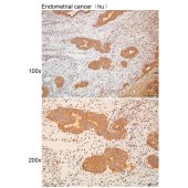 Solarbio K111301P Anti-ADGRD1 Polyclonal Antibody