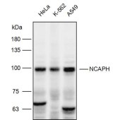 Solarbio K111881P Anti-NCAPH Polyclonal Antibody
