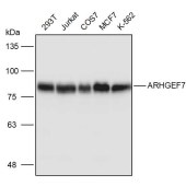 Solarbio K111118P Anti-ARHGEF7 Polyclonal Antibody