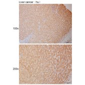 Solarbio K111029P Anti-SERPINA12 Polyclonal Antibody