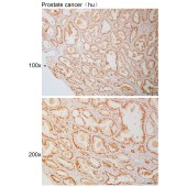 Solarbio K111048P Anti-TERF1 Polyclonal Antibody