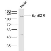Solarbio K009948P Anti-EphB2 Polyclonal Antibody