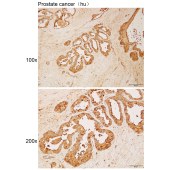 Solarbio K111872P Anti-ZNF596 Polyclonal Antibody