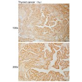 Solarbio K111070P Anti-RAD17 Polyclonal Antibody