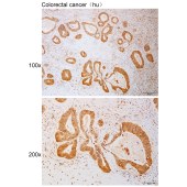 Solarbio K111108P Anti-PNPLA8 Polyclonal Antibody