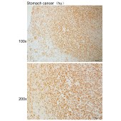 Solarbio K111060P Anti-PIAS1 Polyclonal Antibody