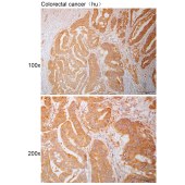 Solarbio K110906P Anti-FAP Polyclonal Antibody