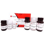 Solarbio G3030 尿酸盐染色试剂盒(Gomori银法)