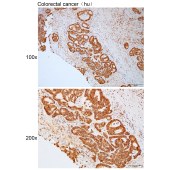 Solarbio K111724P Anti-ABCA3 Polyclonal Antibody