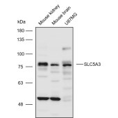 Solarbio K110831P Anti-SLC5A3 Polyclonal Antibody