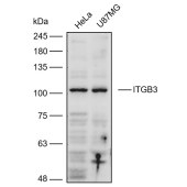 Solarbio K111096P Anti-ITGB3 Polyclonal Antibody