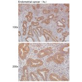 Solarbio K111452P Anti-MMP3 Polyclonal Antibody