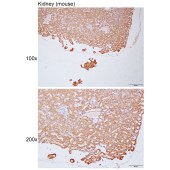 Solarbio K112124P Anti-GMPPA Polyclonal Antibody