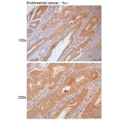 Solarbio K111778P Anti-IPO5 Polyclonal Antibody
