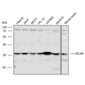 Solarbio K111045P Anti-MC4R Polyclonal Antibody