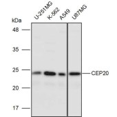Solarbio K111245P Anti-CEP20 Polyclonal Antibody