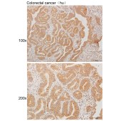 Solarbio K111235P Anti-WARS2 Polyclonal Antibody