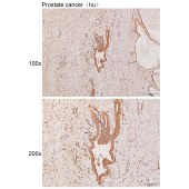 Solarbio K111011P Anti-PELI1 Polyclonal Antibody