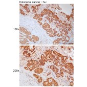 Solarbio K111765P Anti-SIRPB1 Polyclonal Antibody