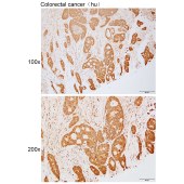 Solarbio K111725P Anti-TAX1BP3 Polyclonal Antibody