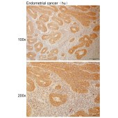 Solarbio K110952P Anti-IPO4 Polyclonal Antibody