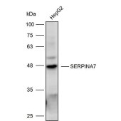 Solarbio K111645P Anti-SERPINA7 Polyclonal Antibody