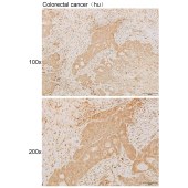 Solarbio K111862P Anti-MVK Polyclonal Antibody