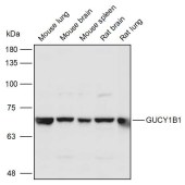 Solarbio K110980P Anti-GUCY1B1 Polyclonal Antibody