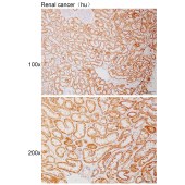 Solarbio K110993P Anti-ADA2 Polyclonal Antibody
