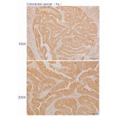 Solarbio K110593P Anti-SERPINB1 Polyclonal Antibody