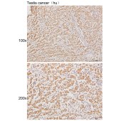 Solarbio K111019P Anti-DDX43 Polyclonal Antibody
