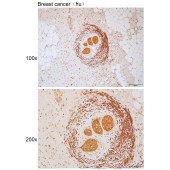 Solarbio K111754P Anti-ITIH5 Polyclonal Antibody