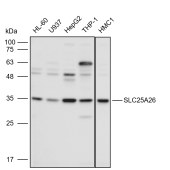 Solarbio K111604P Anti-SLC25A26 Polyclonal Antibody