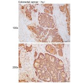 Solarbio K111754P Anti-ITIH5 Polyclonal Antibody