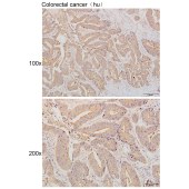 Solarbio K111278P Anti-STK24 Polyclonal Antibody