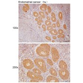 Solarbio K111748P Anti-MTARC2 Polyclonal Antibody