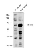 Solarbio K111731P Anti-VPS52 Polyclonal Antibody